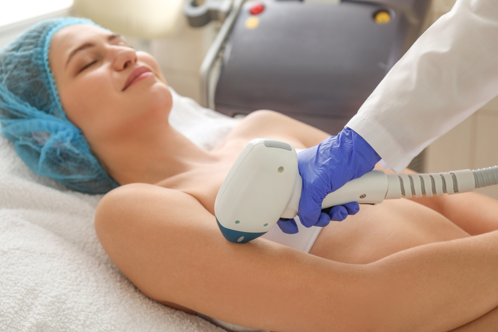 laser hair removal breastfeeding