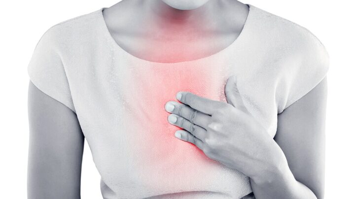 Heartburn: Causes and What Helps