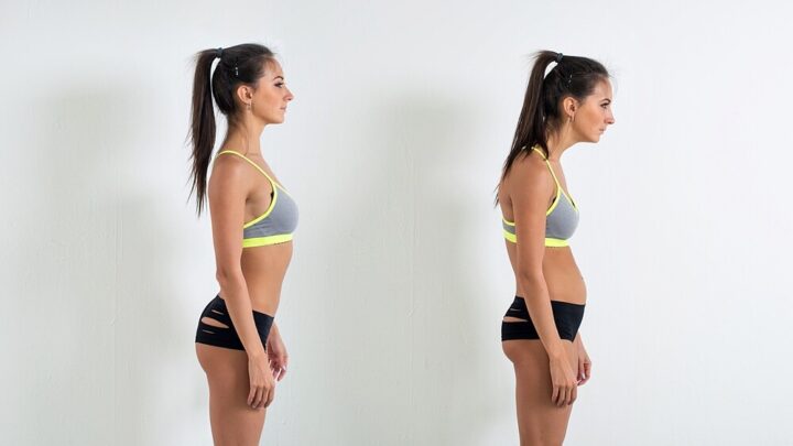 Hunchback: Causes and Treatment Methods