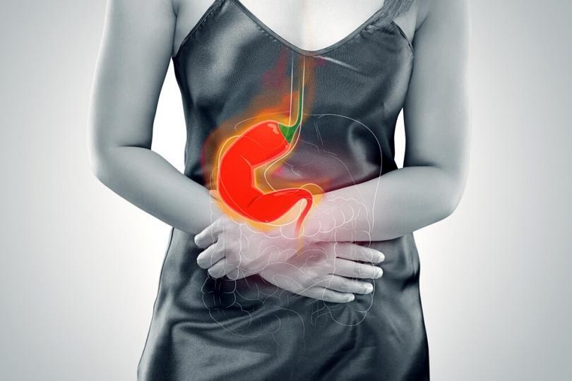 Acid reflux cause leg pain Acid reflux cause leg pain