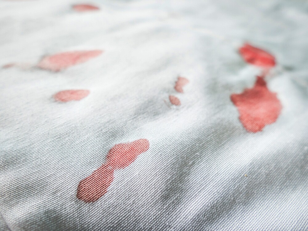 Removing Blood Stains: The Best Home Remedies | Women's ...