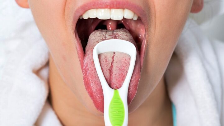 What Causes a Coated Tongue: How to Get Rid of It