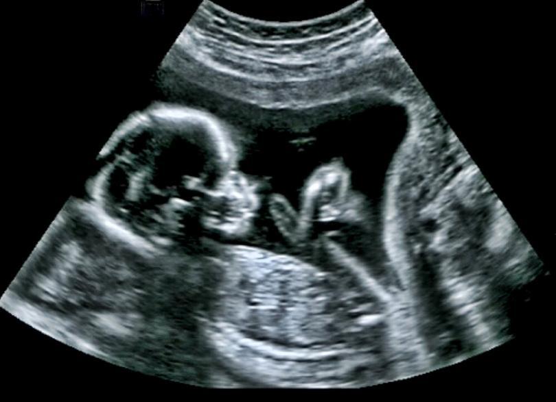 CrownRump Length What is That? Women's Alphabet