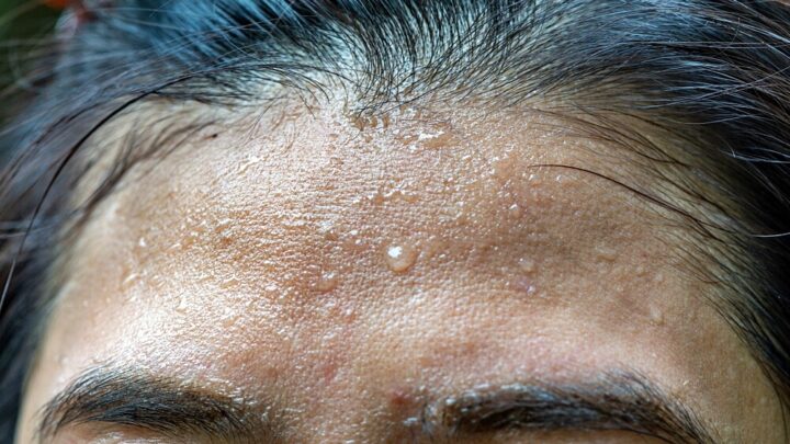 How To Stop Excessive Head Sweating