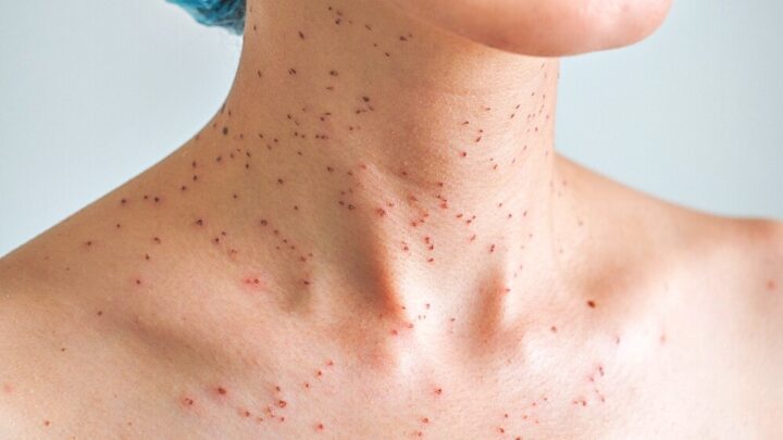Red Spots on The Skin: 7 Possible Causes and Treatments