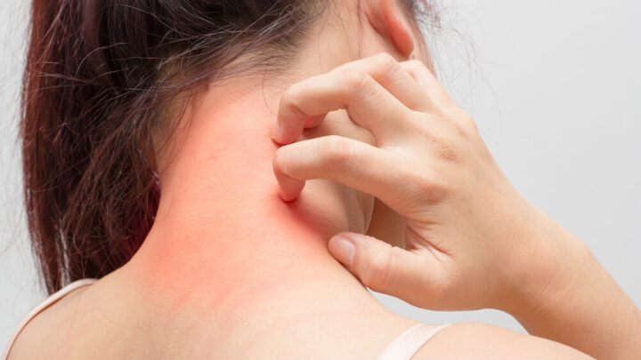 Skin Allergy: All You Need to Know