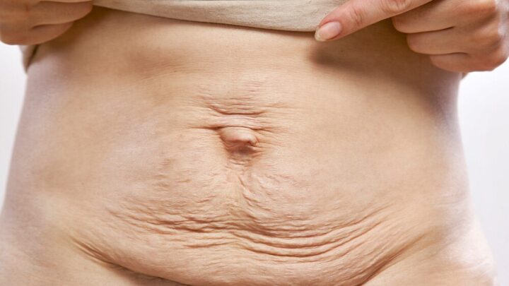 After-Baby Bodies: Let’s See Your Bodies