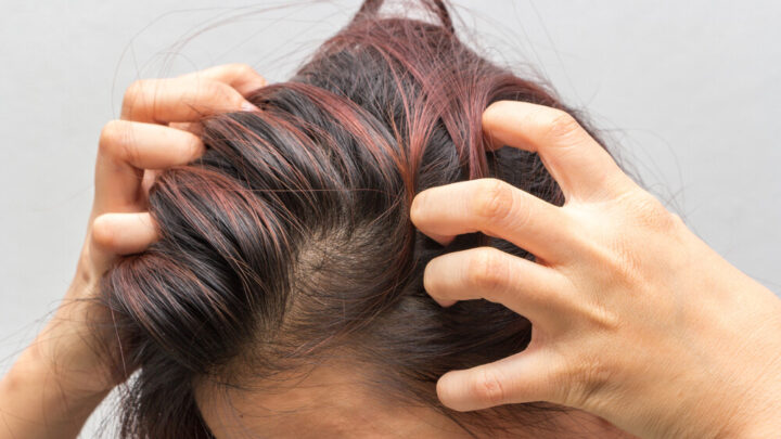 Itchy Scalp: Causes and Home Remedies