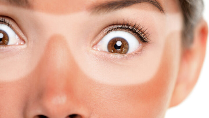 Sunburn on The Face: That Helps Immediately!