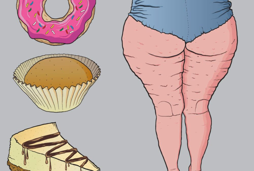 7 Surprising Foods That Cause Cellulite