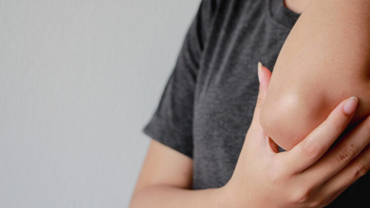 How to Get Rid of Dry, Rough Elbows in 10 Minutes