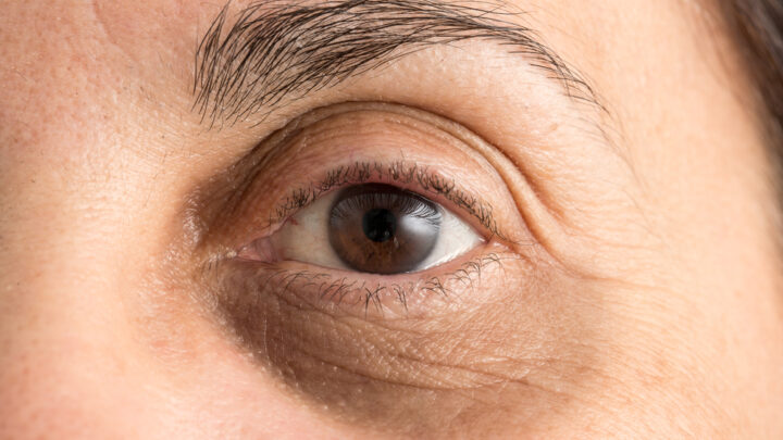 How to Cover Dark Circles Under Eyes: Step-by-Step Instructions