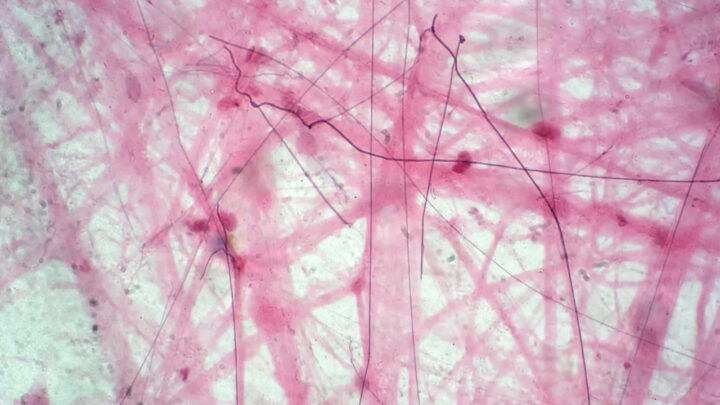 How To Strengthen Connective Tissue: 10 Simple To-Dos