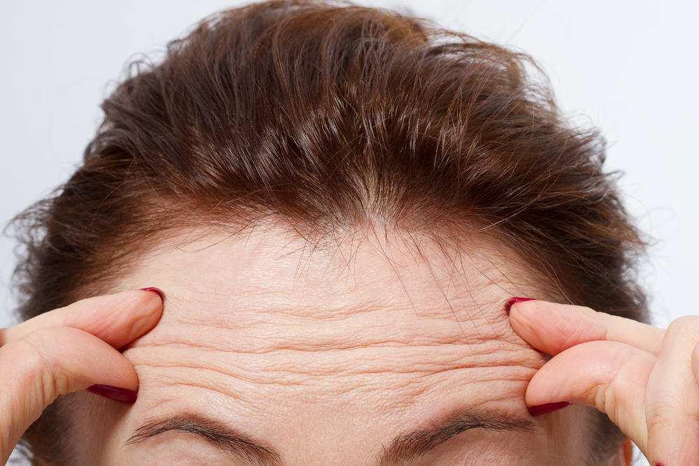 Forehead Wrinkles: How to Get Rid of Them
