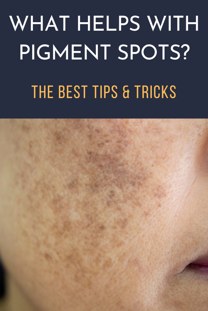 What Helps with Pigment Spots? The Best Tips & Tricks | Women's Alphabet