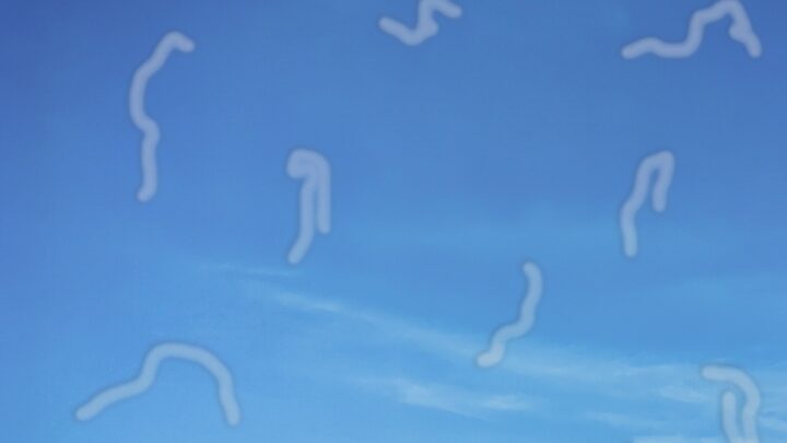 Why Do You Get Eye Floaters?