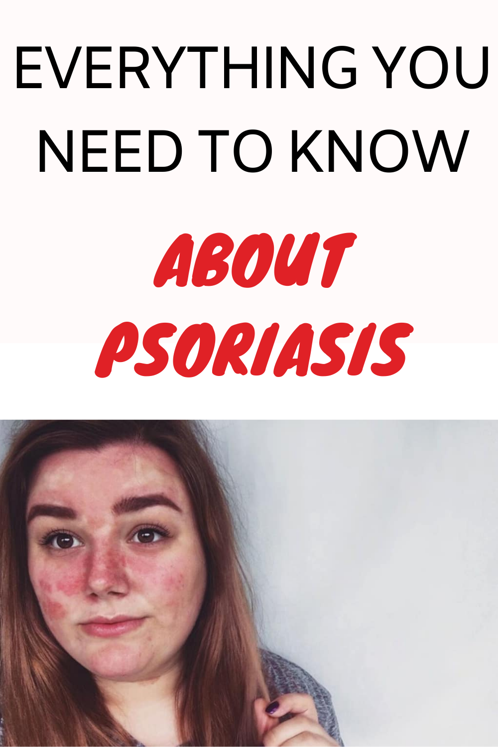 Everything You Need to Know About Psoriasis
