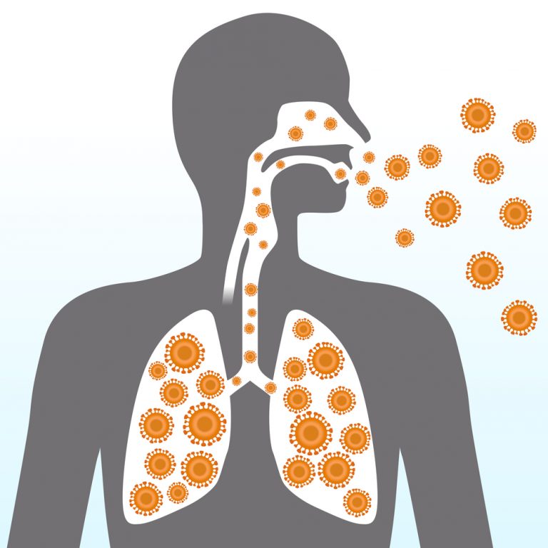 10 Best Home Remedies For Upper Respiratory Tract Infections Women s