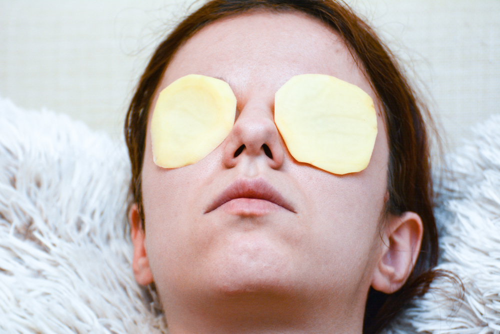 potatoes for dark circles