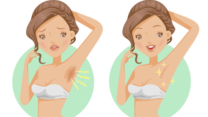 Get Rid of Dark Underarms | 5 Effective Home Remedies for Underarms