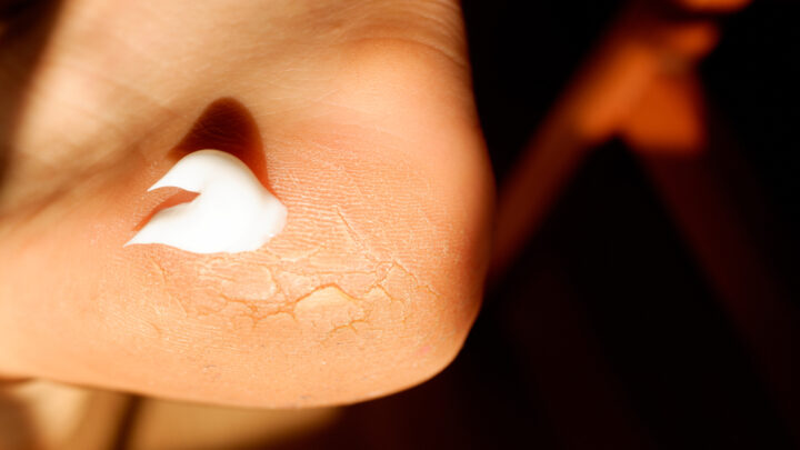 What is Urea And Its Benefits in Skin Care?