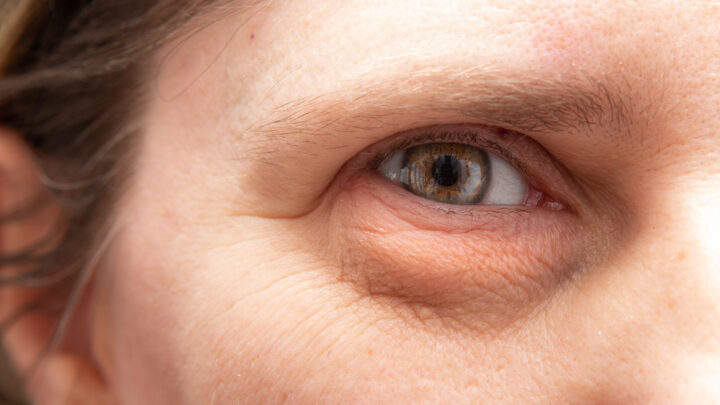 How to Fix Droopy Eyelids: 3 Pro Makeup Tips