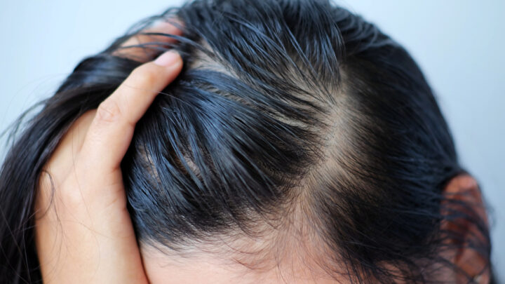 Best Ways to Fix Greasy Hair