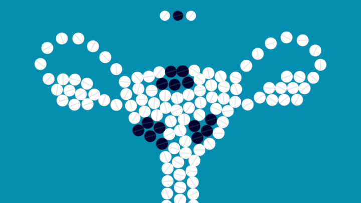 6 Health Problems Caused by Uterine Fibroids