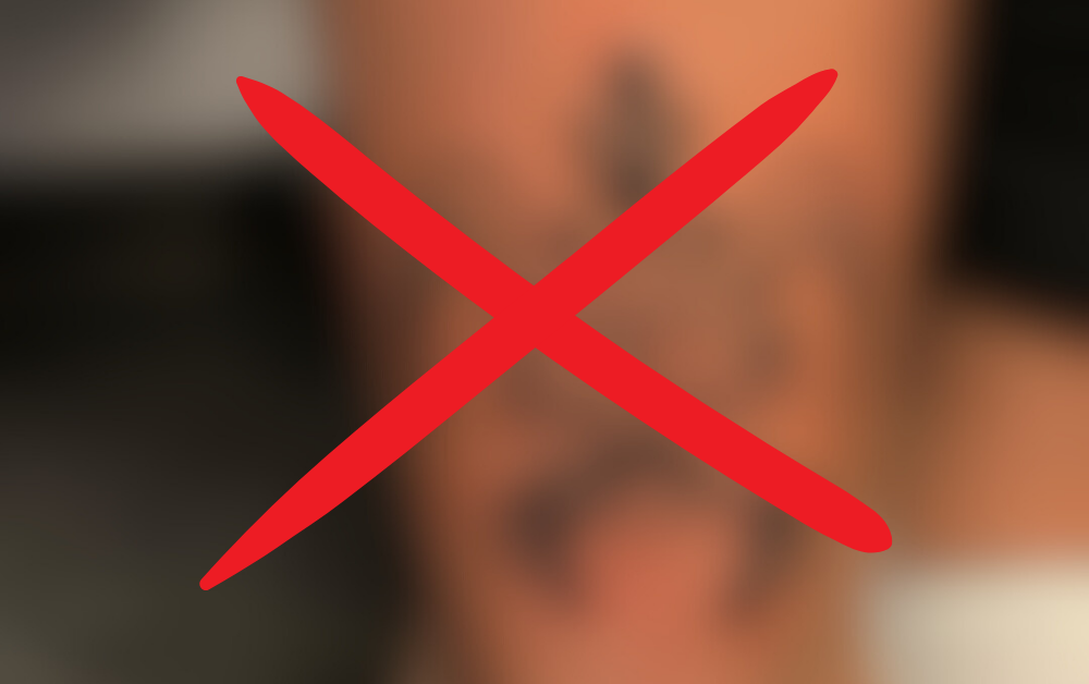 A blurred-out tattoo with a red X mark symbolizing a warning against tattoos.