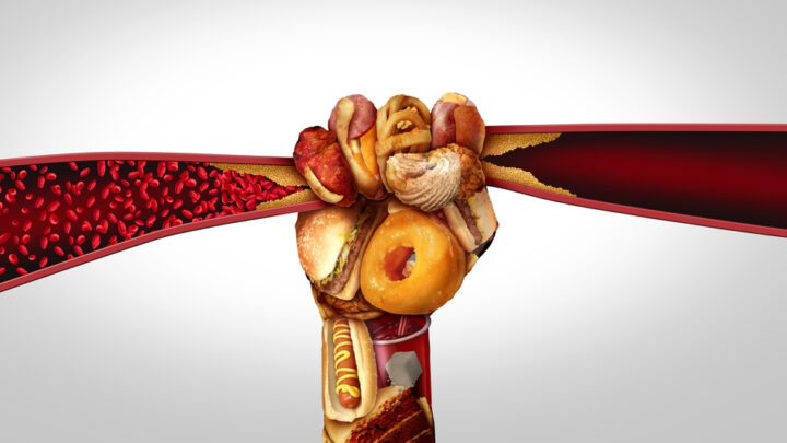 Foods That You Should Eat Daily for Clean Arteries