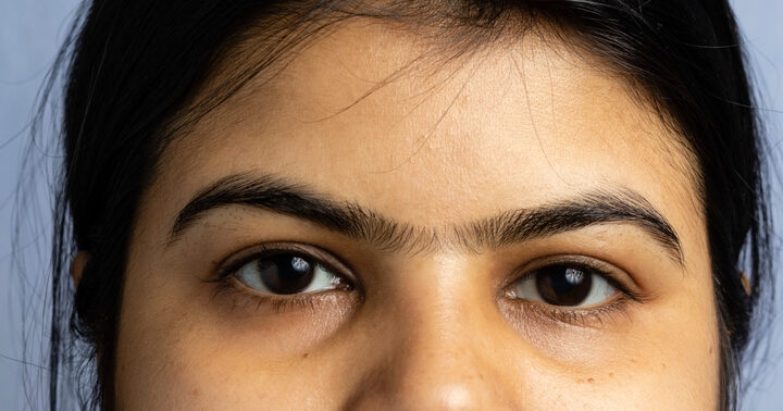 How To Get Rid Of A Unibrow Naturally: The Ultimate Guide