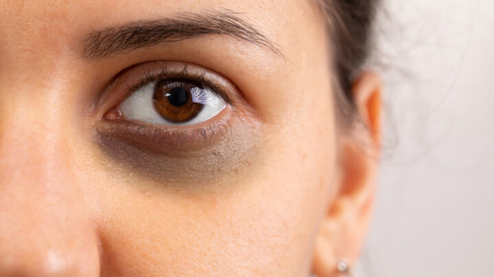 Neutralize Dark Undereye Circles with This Peach Color Corrector