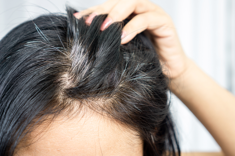 Regrow Hair with This Common Kitchen Ingredient