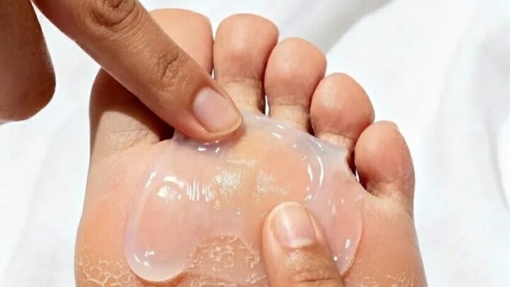 The Overnight “Foot Slugging” Method for Baby-Soft Heels in One Night