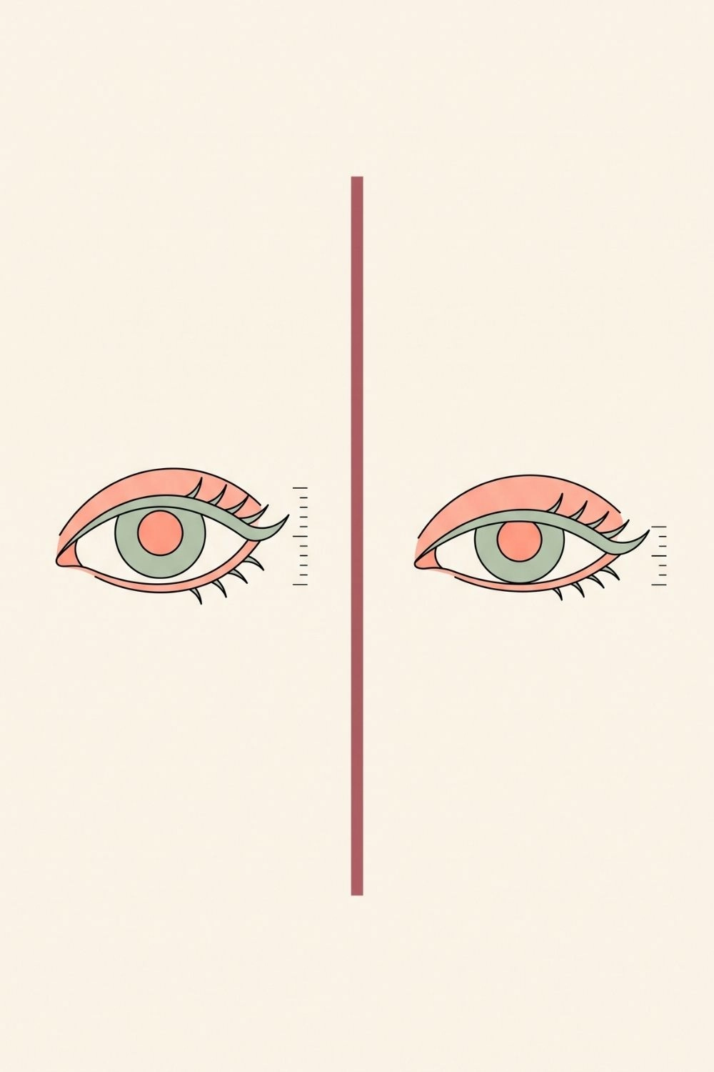Schematic comparing two eye shapes with naturally different lid space