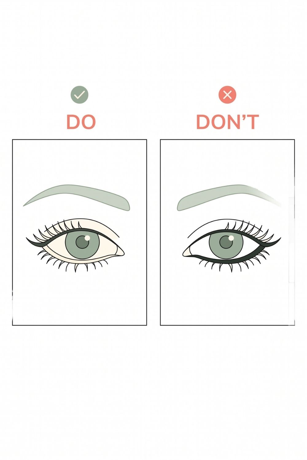 Side-by-side schematic comparison of an eye with a visible pale waterline versus one with the waterline fully coloured in dark